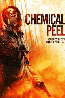 Chemical Peel